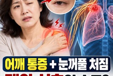 오십견인 줄 알았는데 폐암? 어깨 통증과 함께 눈꺼풀이 처진다면 확인해야 할 신호