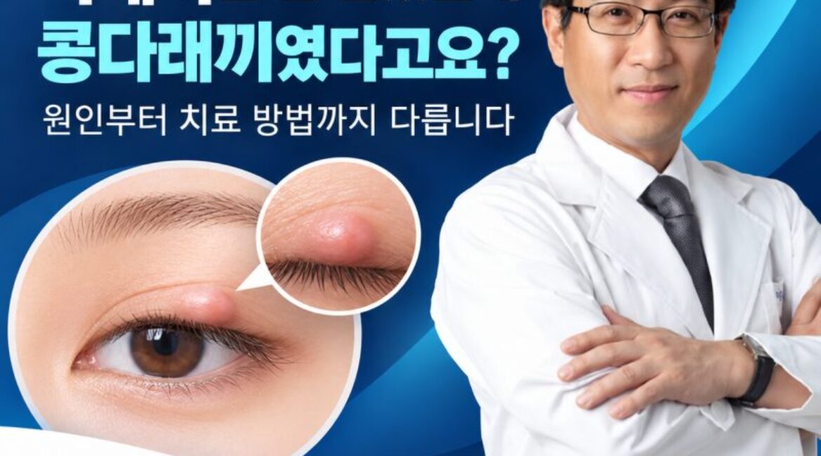 다래끼인 줄 알았는데 콩다래끼였다고요? 치료 방법부터 다릅니다