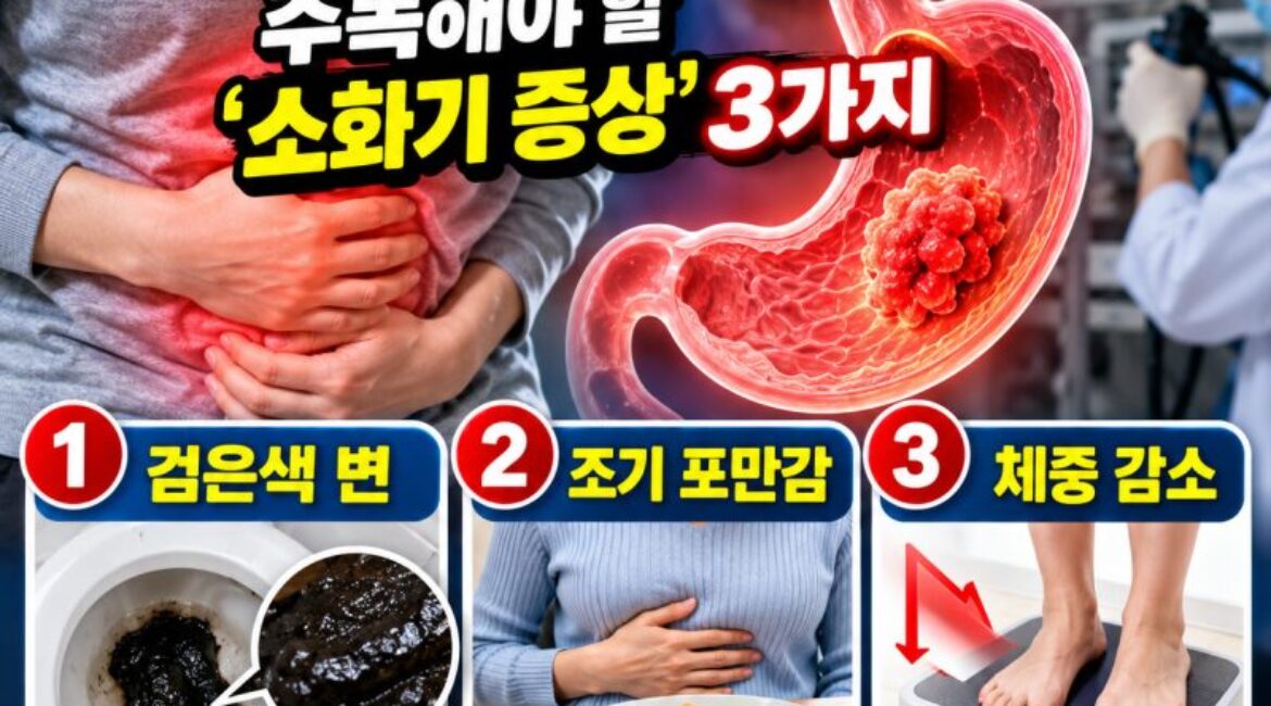 위암이 보내는 신호?검은 변·조기 포만감·체중감소, 그냥 넘기면 안 되는 이유