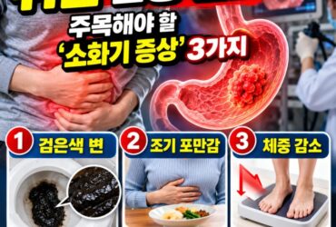 위암이 보내는 신호?검은 변·조기 포만감·체중감소, 그냥 넘기면 안 되는 이유