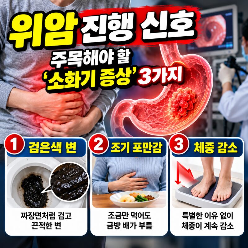 위암이 보내는 신호?검은 변·조기 포만감·체중감소, 그냥 넘기면 안 되는 이유
