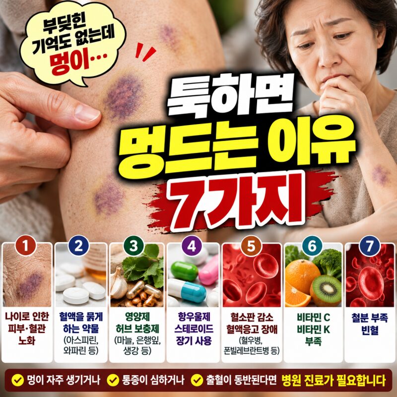 부딪힌 기억도 없는데 멍이 생긴다? 쉽게 멍드는 이유 7가지와 대처법