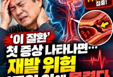 뇌경색 재발 위험, 첫 1주일에 집중된다…목·머리 혈관이 찢어지는 '두개경부동맥박리' 주의보