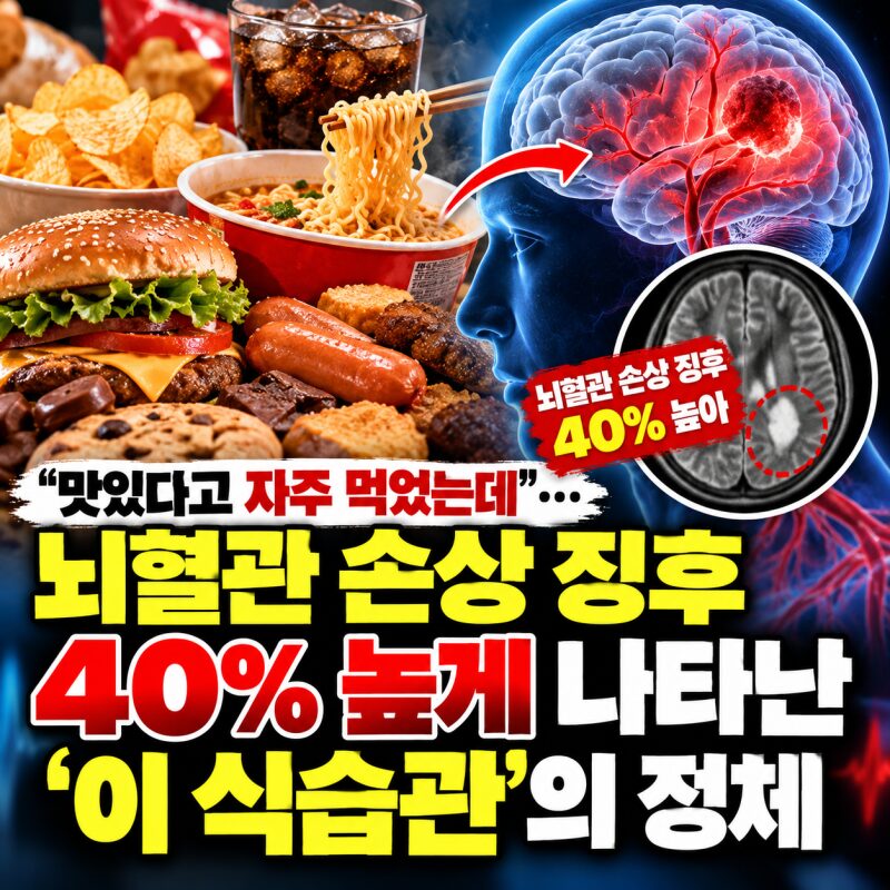 "맛있어서 자주 먹었는데…" 뇌혈관 손상 위험 40% 높게 나타난 음식의 정체! 매일 먹는 라면·과자·가공식품 괜찮을까?