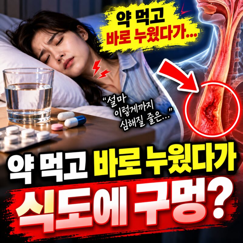 “약 먹고 바로 누웠다가 식도에 구멍?” 물 한 모금으로 삼킨 알약이 위험한 이유! 반드시 알아야 할 복약 습관