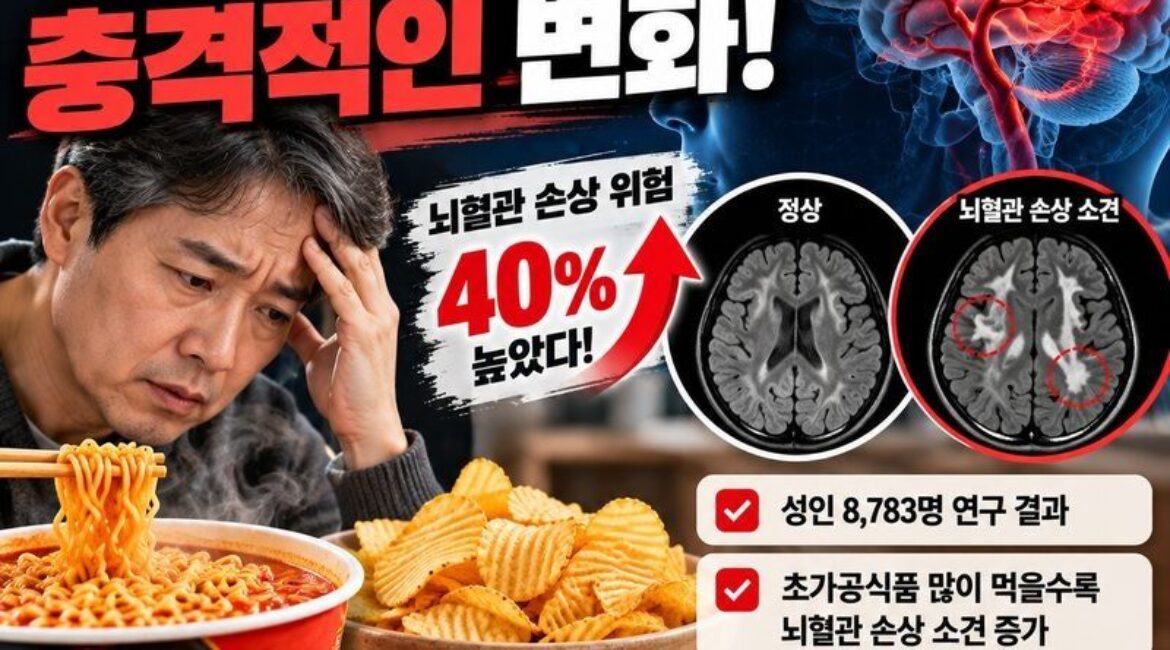 라면·과자 자주 먹는 4060, 뇌 MRI에 이상 신호? 8,783명 연구에서 발견된 놀라운 결과