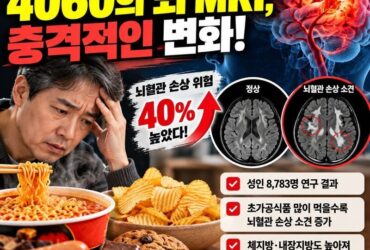 라면·과자 자주 먹는 4060, 뇌 MRI에 이상 신호? 8,783명 연구에서 발견된 놀라운 결과