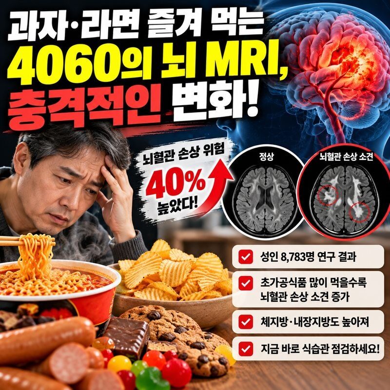 라면·과자 자주 먹는 4060, 뇌 MRI에 이상 신호? 8,783명 연구에서 발견된 놀라운 결과