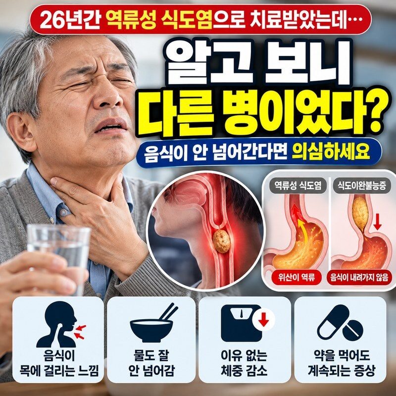 “26년간 역류성 식도염인 줄 알았는데…” 음식이 목에 걸리고 물도 안 넘어간다면 의심해야 할 병
