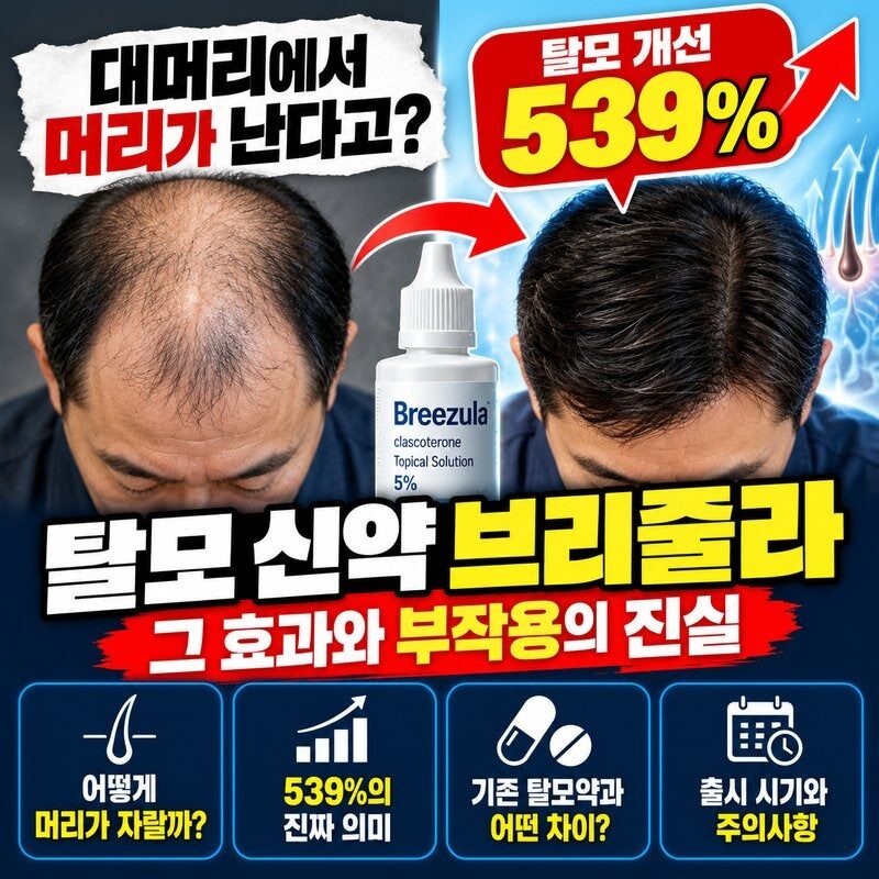 “대머리도 다시 머리 난다?” 탈모 신약 브리줄라 539% 효과의 진실…기존 탈모약보다 좋을까?